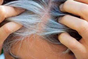 Un traitement élimine les cheveux gris pour toujours